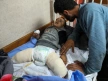 Children with amputations in Gaza