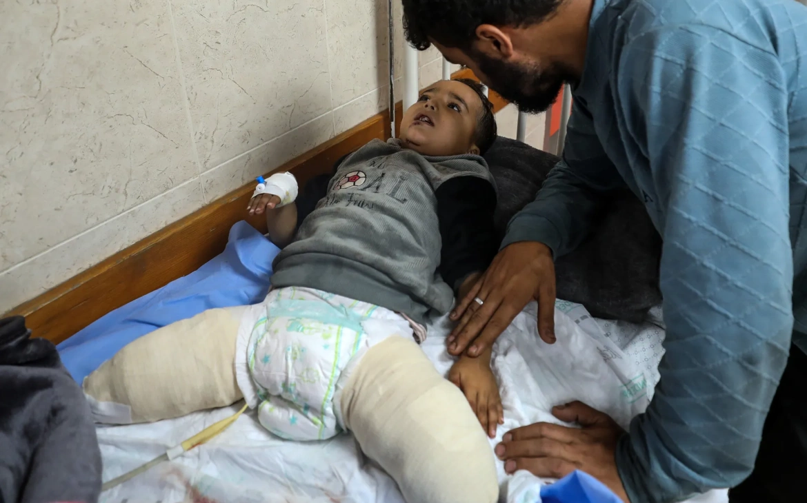 Children with amputations in Gaza