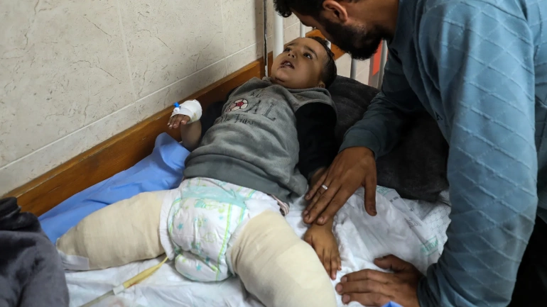 Children with amputations in Gaza
